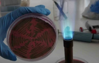 Çiğ süt, gıdayla bulaşan idrar yolu enfeksiyonlarına kapı açıyor