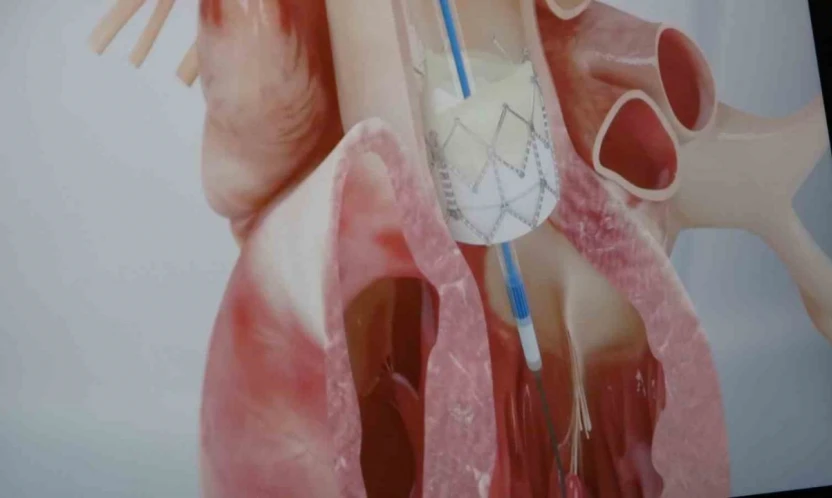 Prof. Dr. Pekdemir: 'Gençlerde ani ölümlerin yüzde 90'ı genetik nedenlerden kaynaklanıyor'